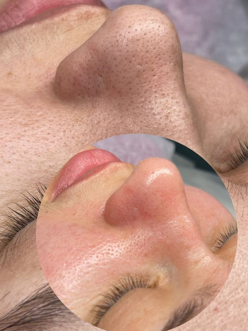 Lum K-Beauty Clarifying Serum — Pores, Blackheads & Sebum Control, 150ml